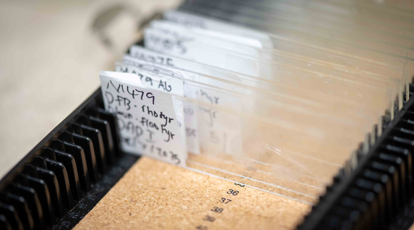 Rat Brain Slides from a student researcher's project from the 2025 Summer Research Program