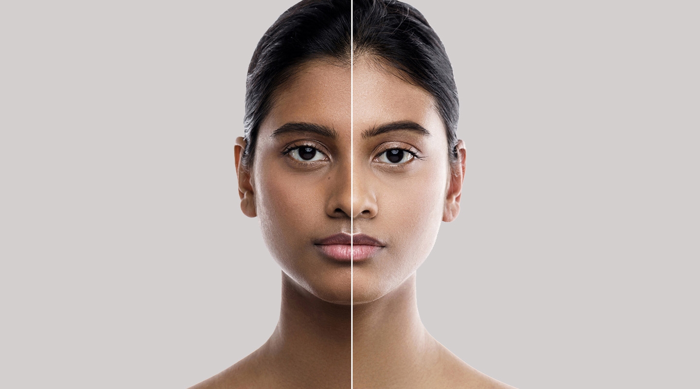 Indian woman with lightened skin