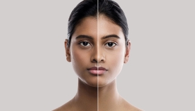 Indian woman with lightened skin